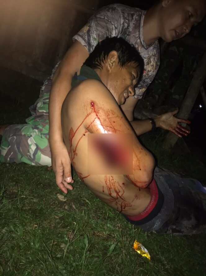 
 Korban luka yang ditembak OTK semalam, Kamis.